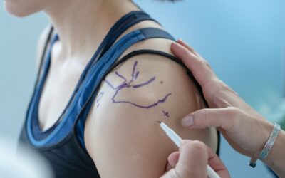 Treći kurs intraartikularnog davanja injekcija
