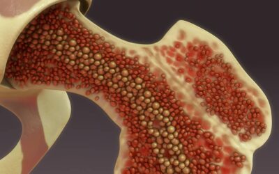 Bone Marrow Aspirate Concentrate versus Platelet Rich Plasma or Hyaluronic Acid for the Treatment of Knee Osteoarthritis